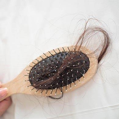 Alopecia Androgenetica
